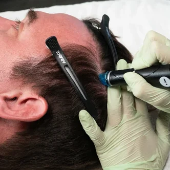 Hydrafacial Keravive Scalp Treatment